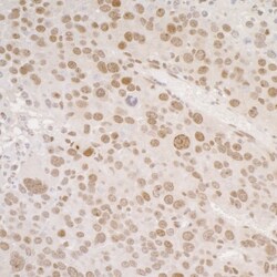 Histone H2AX, p Ser139 Antibody, Novus Biologicals 0.1mL; Unlabeled:Antibodies,